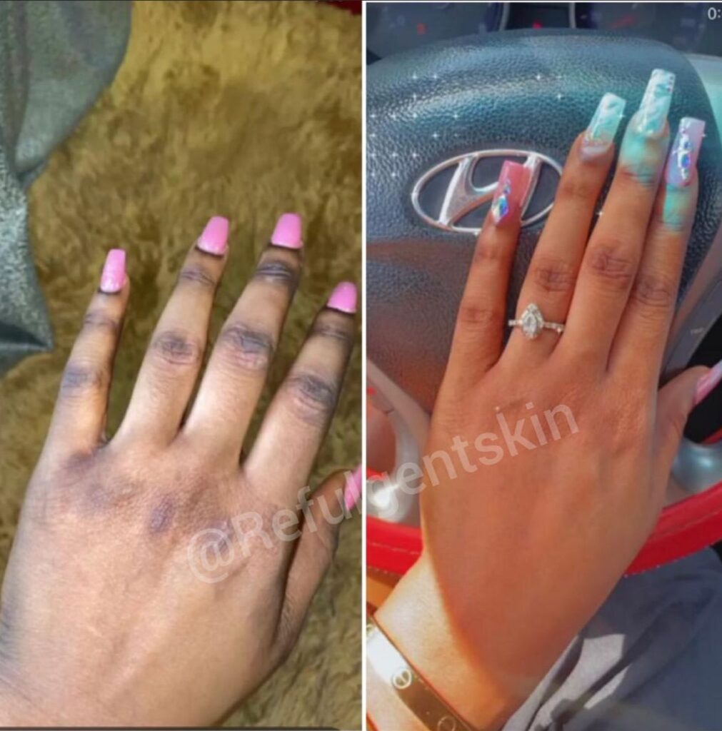 Aesthetic clinic Abuja Aesthetic clinic Lagos Skincare clinic Abuja Skincare clinic Lagos Botox and fillers Nigeria Chemical peels and skin rejuvenation Acne and hyperpigmentation treatment Weight loss and body contouring Skin brightening and lightening treatments