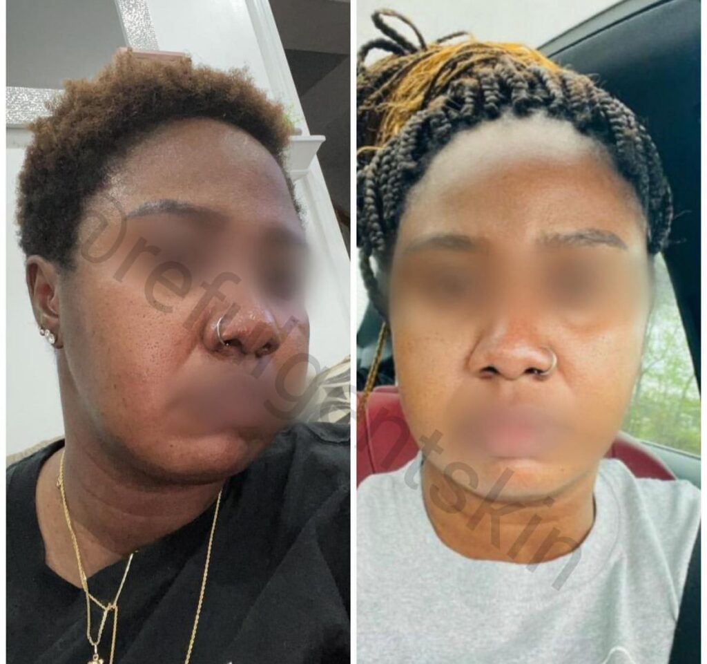 Aesthetic clinic Abuja Aesthetic clinic Lagos Skincare clinic Abuja Skincare clinic Lagos Botox and fillers Nigeria Chemical peels and skin rejuvenation Acne and hyperpigmentation treatment Weight loss and body contouring Skin brightening and lightening treatments