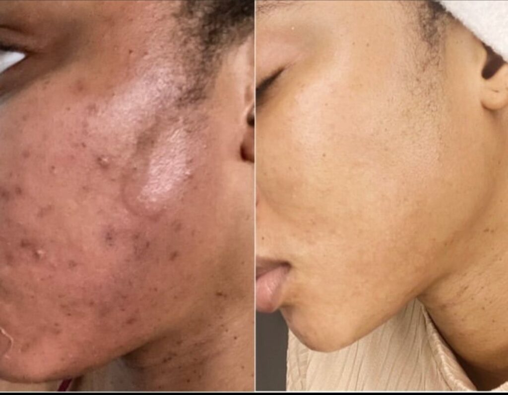 Aesthetic clinic Abuja Aesthetic clinic Lagos Skincare clinic Abuja Skincare clinic Lagos Botox and fillers Nigeria Chemical peels and skin rejuvenation Acne and hyperpigmentation treatment Weight loss and body contouring Skin brightening and lightening treatments