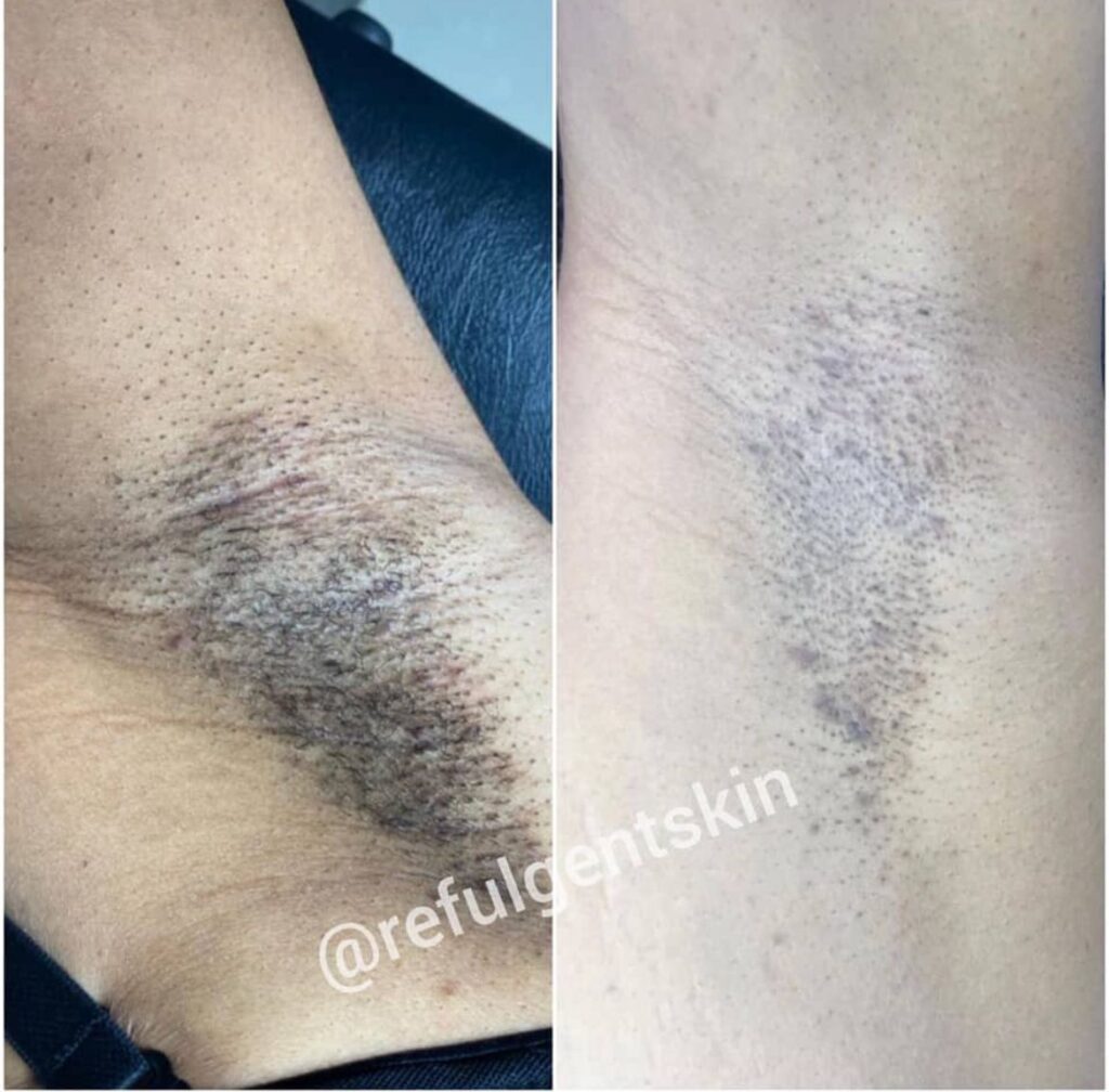 Aesthetic clinic Abuja Aesthetic clinic Lagos Skincare clinic Abuja Skincare clinic Lagos Botox and fillers Nigeria Chemical peels and skin rejuvenation Acne and hyperpigmentation treatment Weight loss and body contouring Skin brightening and lightening treatments