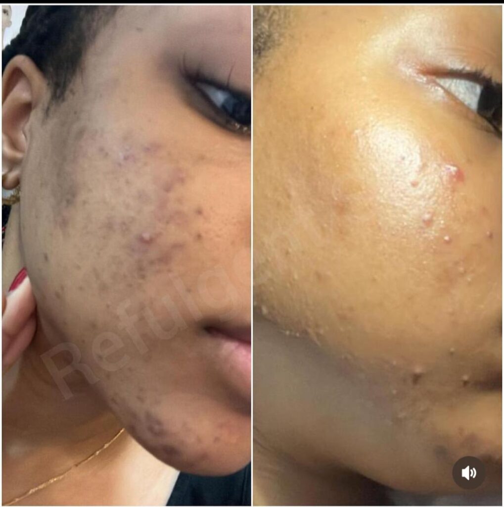Aesthetic clinic Abuja Aesthetic clinic Lagos Skincare clinic Abuja Skincare clinic Lagos Botox and fillers Nigeria Chemical peels and skin rejuvenation Acne and hyperpigmentation treatment Weight loss and body contouring Skin brightening and lightening treatments